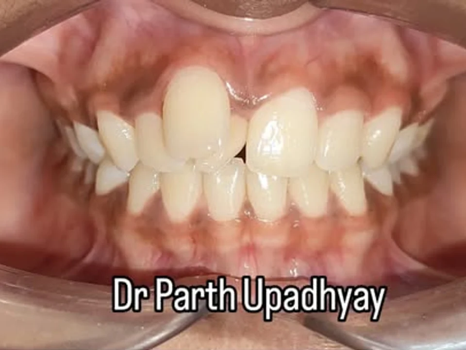 Before smile restoration